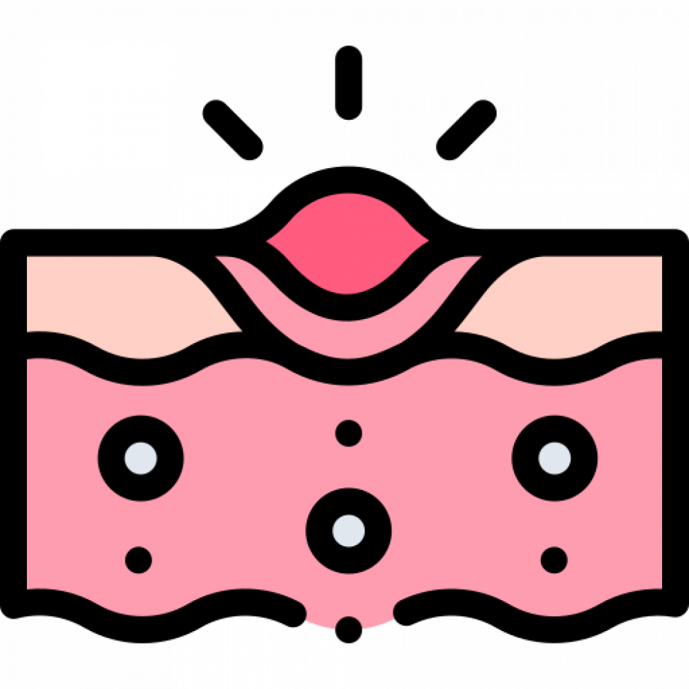 pimple